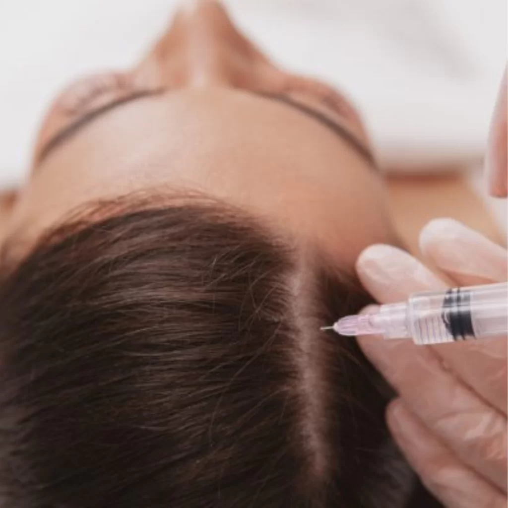 tratamento de alopecia