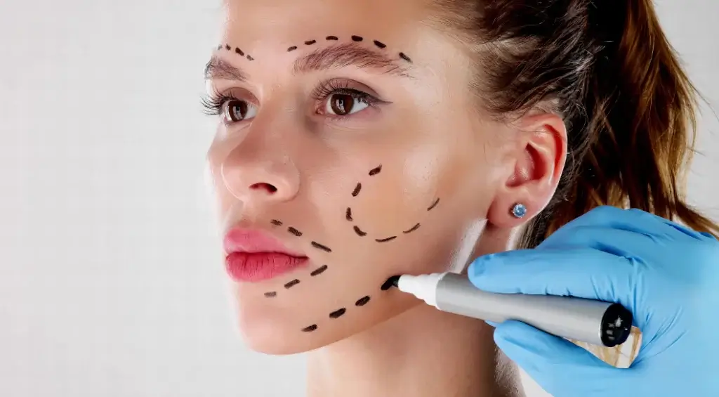 harmonização facial